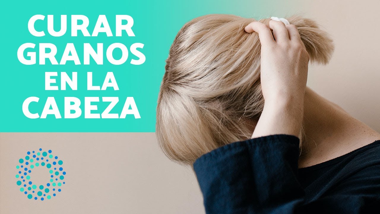 granitos en la nuca por estres