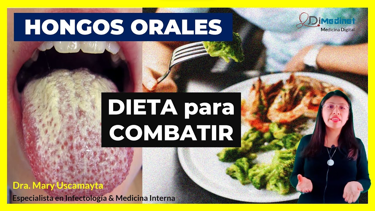 que no comer con candidiasis oral