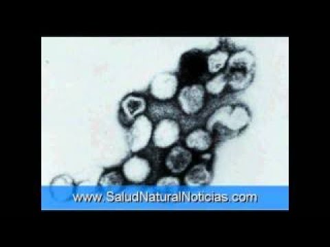 saw palmetto para que sirve en mujeres