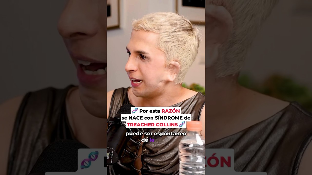 síndrome de treacher collins antes y después