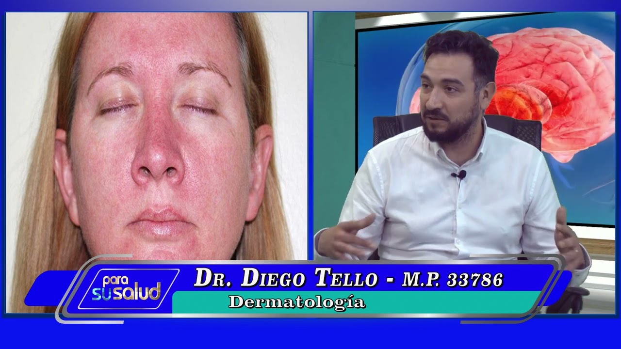 calor en la cara y enrojecimiento