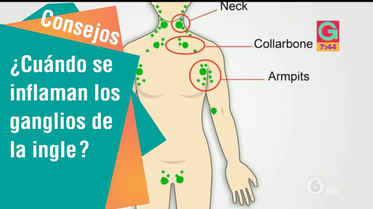 entrepierna bulto en la ingle mujer