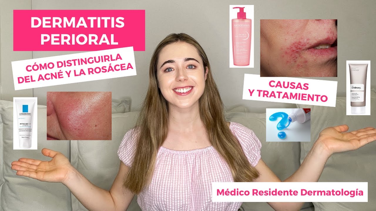 granos al lado de la boca