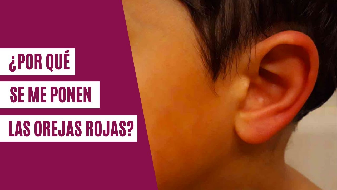 porque se me calientan las orejas