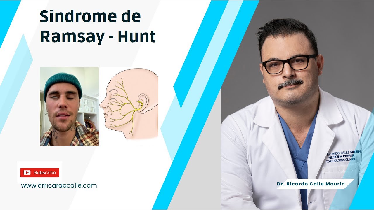 sindrome ramsay hunt tiempo de recuperacion
