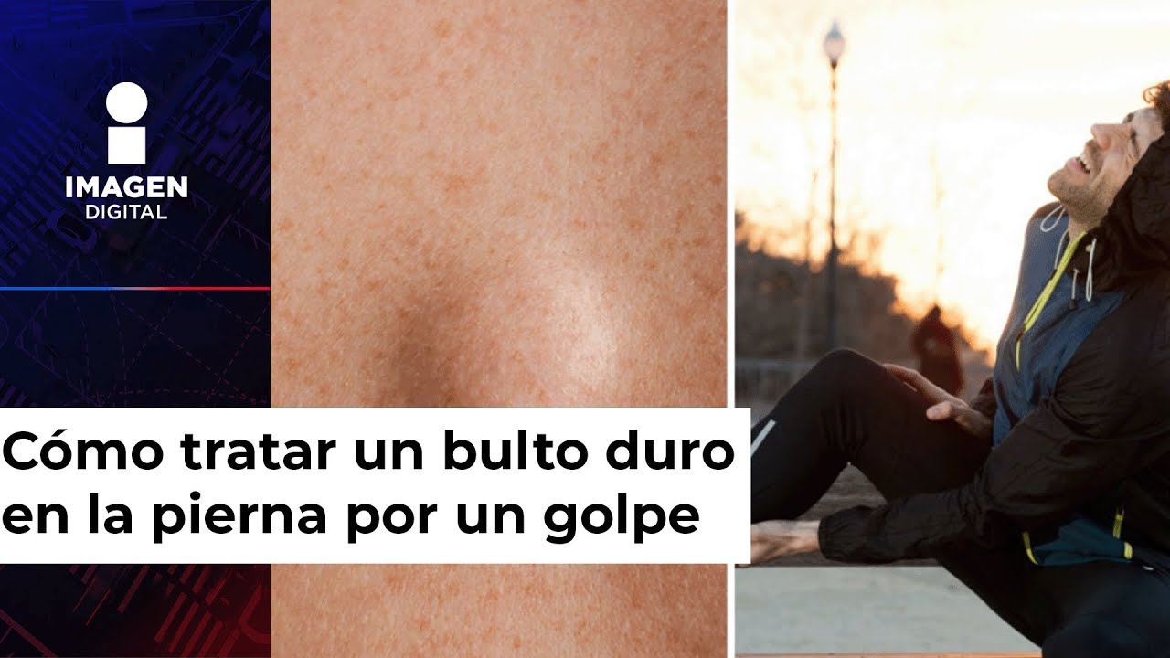 bulto interno despues de un golpe