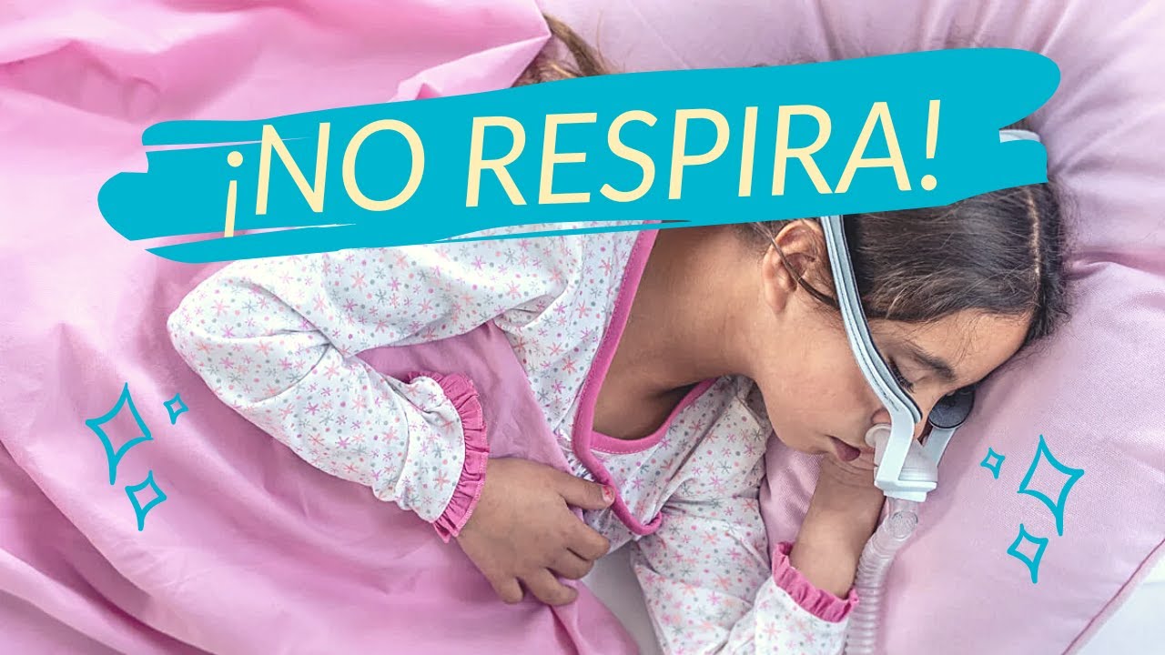 es grave la apnea del sueño en niños