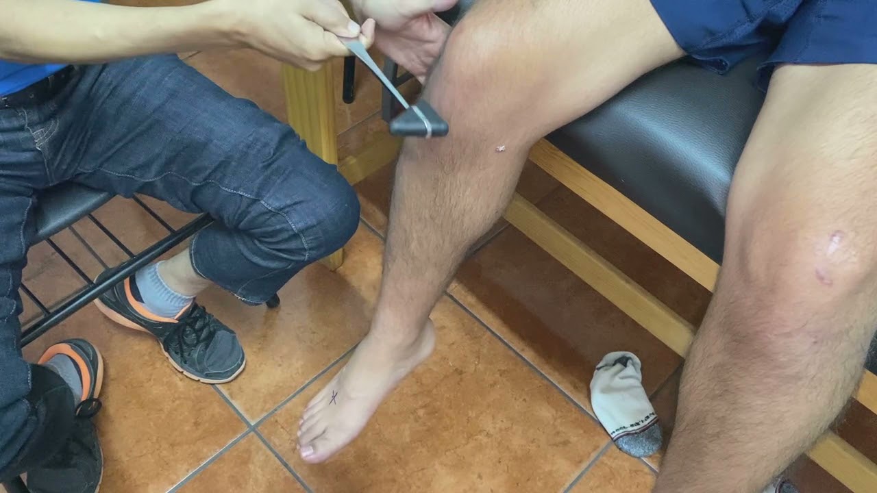 es normal no tener reflejos en la rodilla