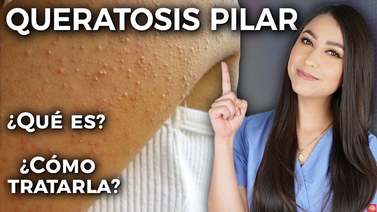 granitos por dentro de la piel