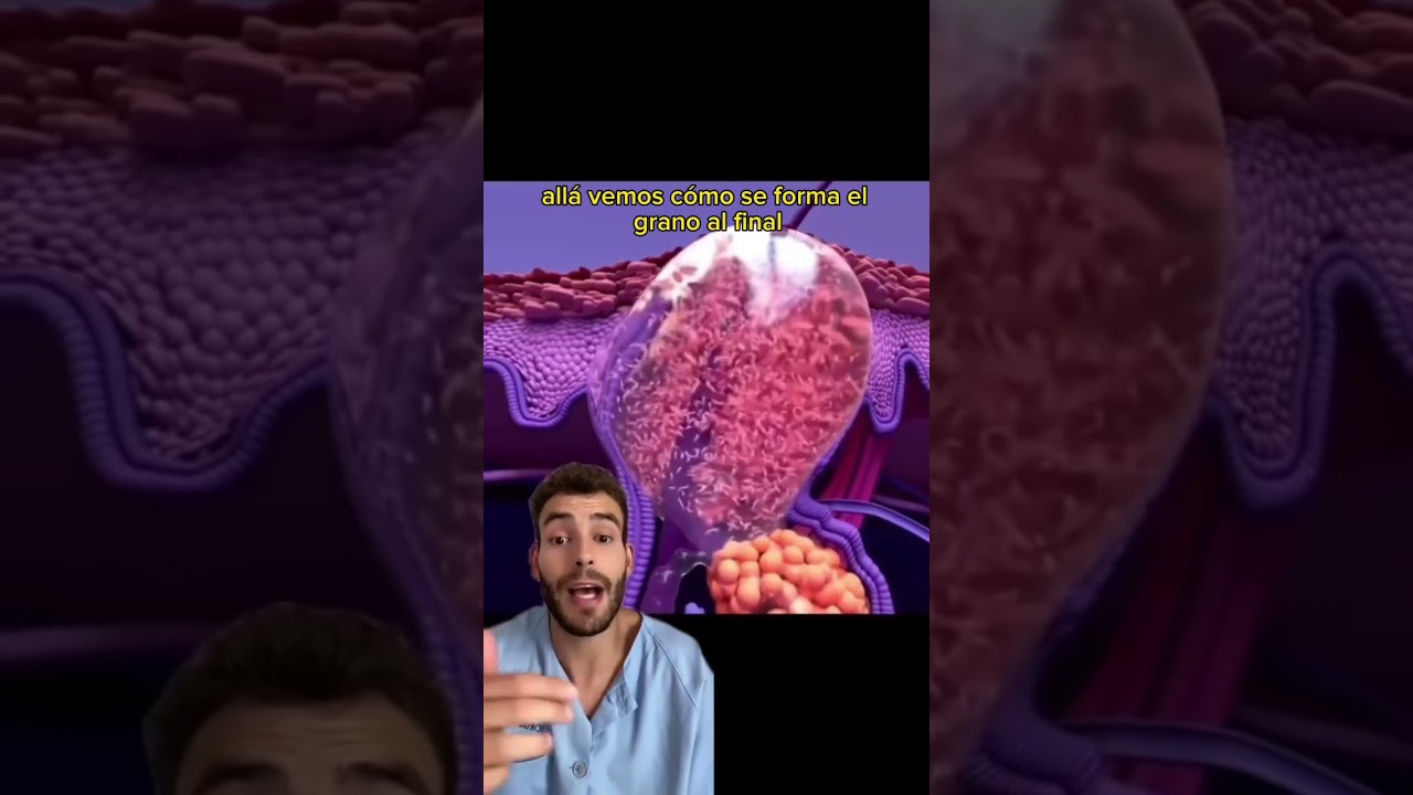 granos por dentro de la piel