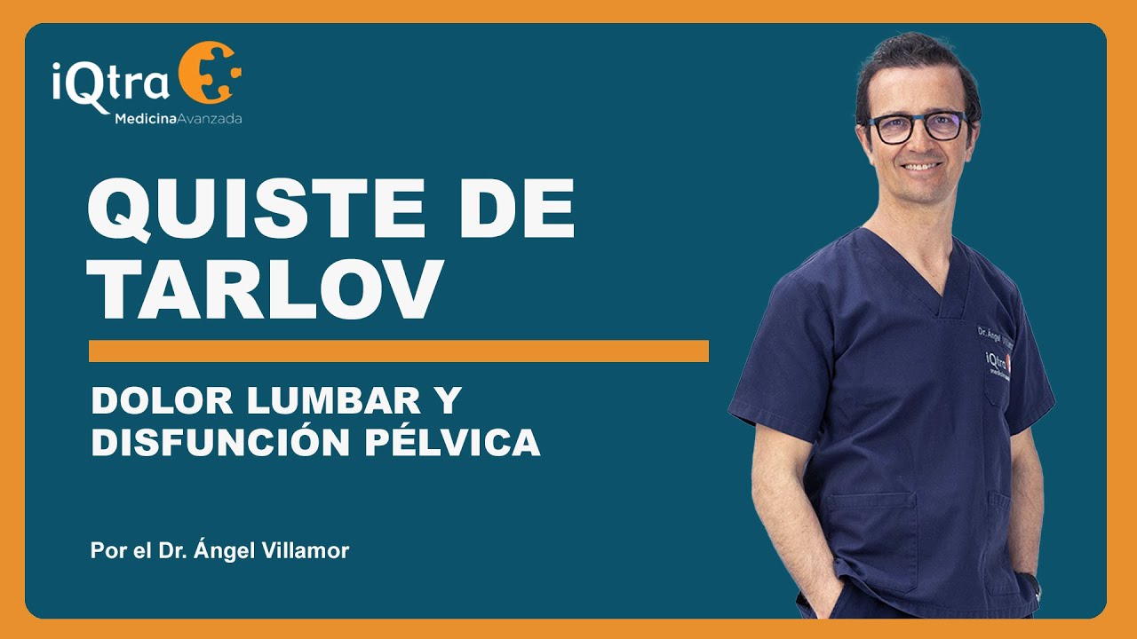 medicos especialistas en quiste de tarlov