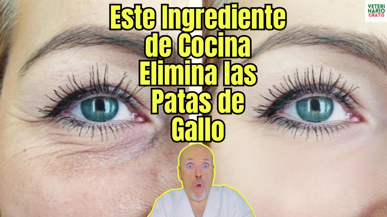 mejor crema para eliminar las patas de gallo