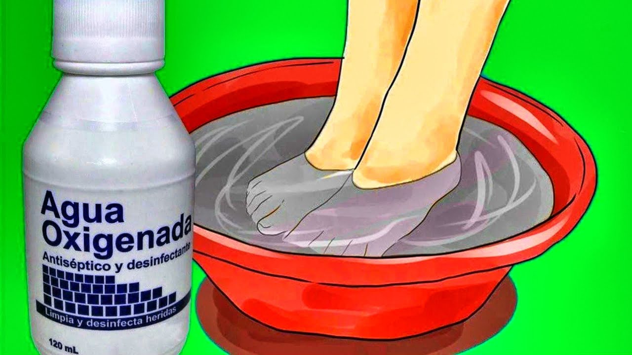 para que sirve el agua oxigenada heridas