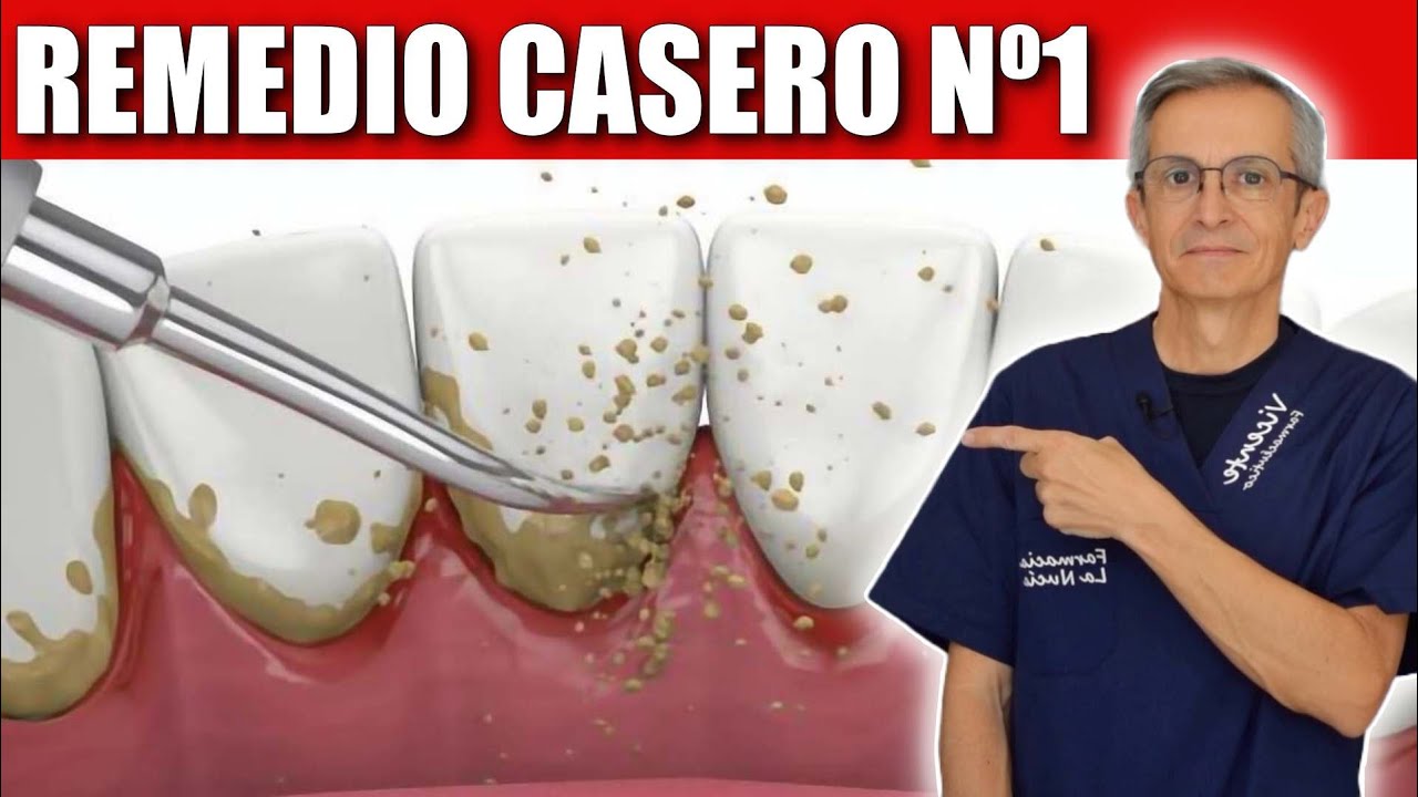 pasta de dientes para eliminar sarro