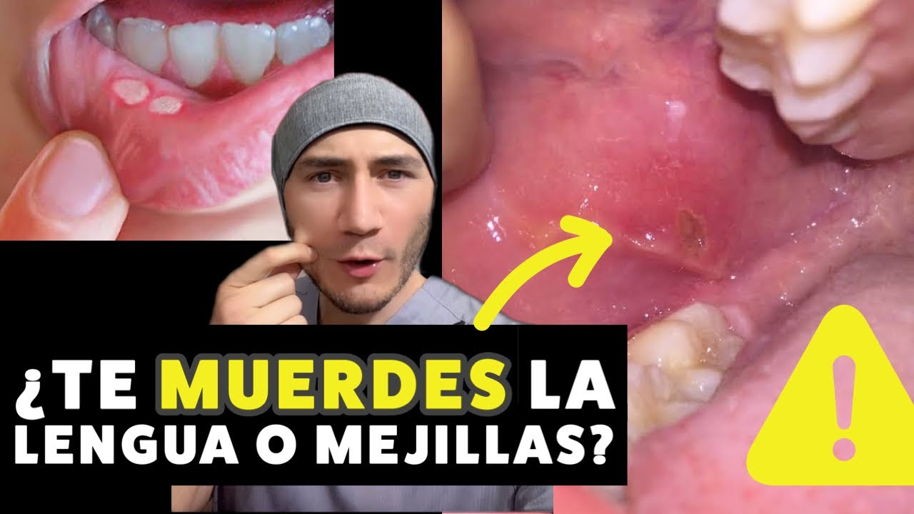 porque me muerdo la boca por dentro al comer