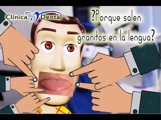 puntos en la lengua que duelen