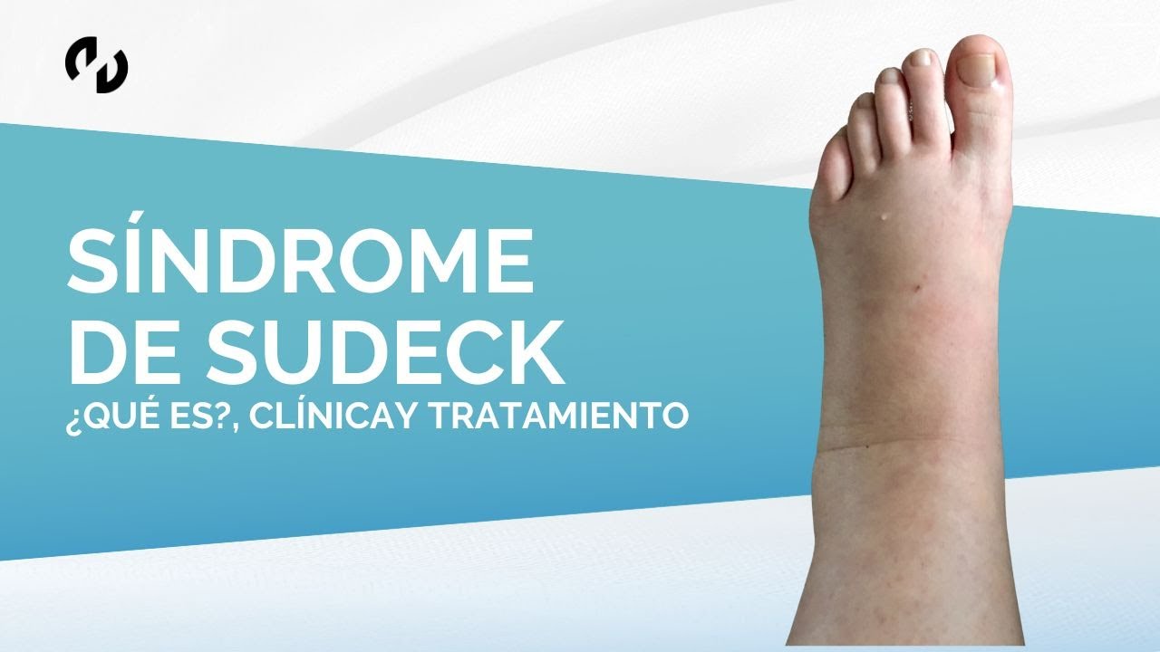 que es el sindrome de sudeck