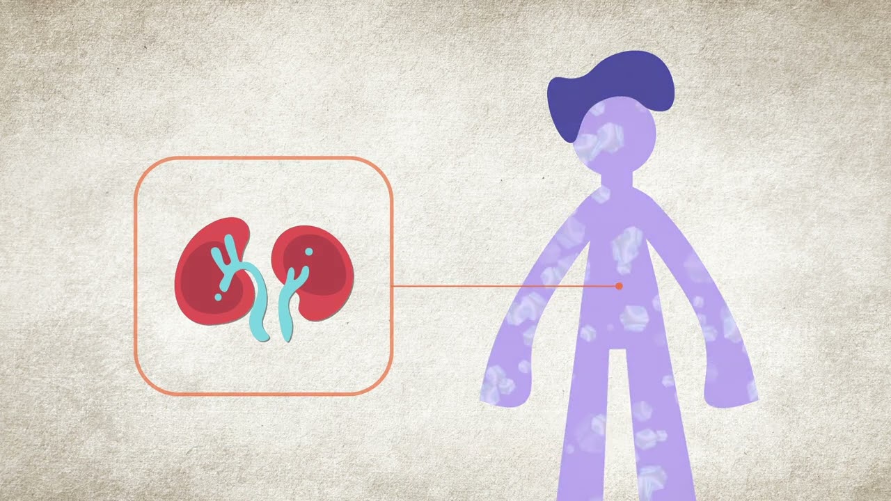 qué pasa si una persona tiene el potasio alto