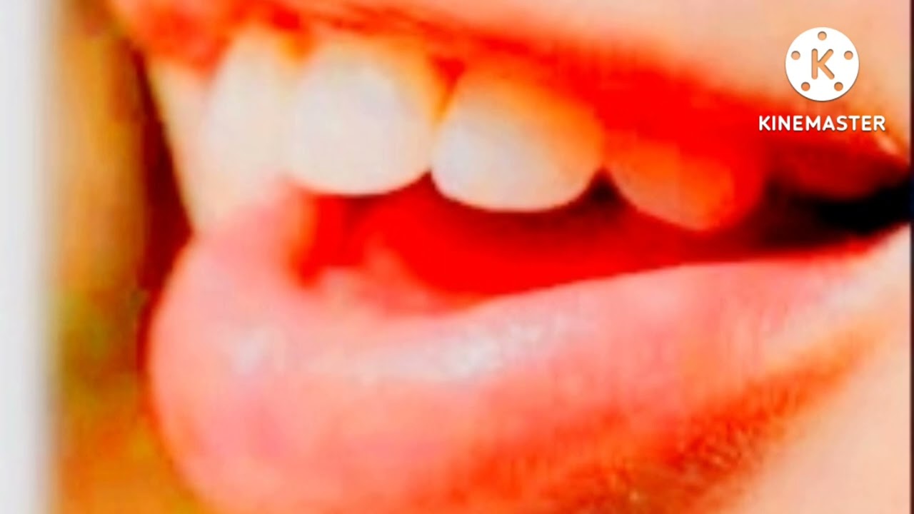 soñar que se te mueven los dientes de arriba