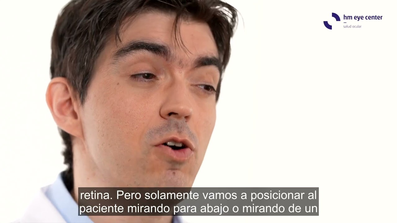 cuanto tiempo tarda en cicatrizar la retina