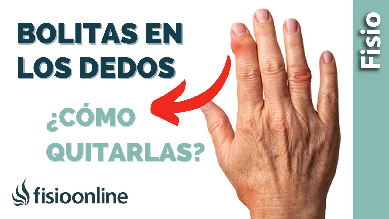 deformación de los dedos de las manos