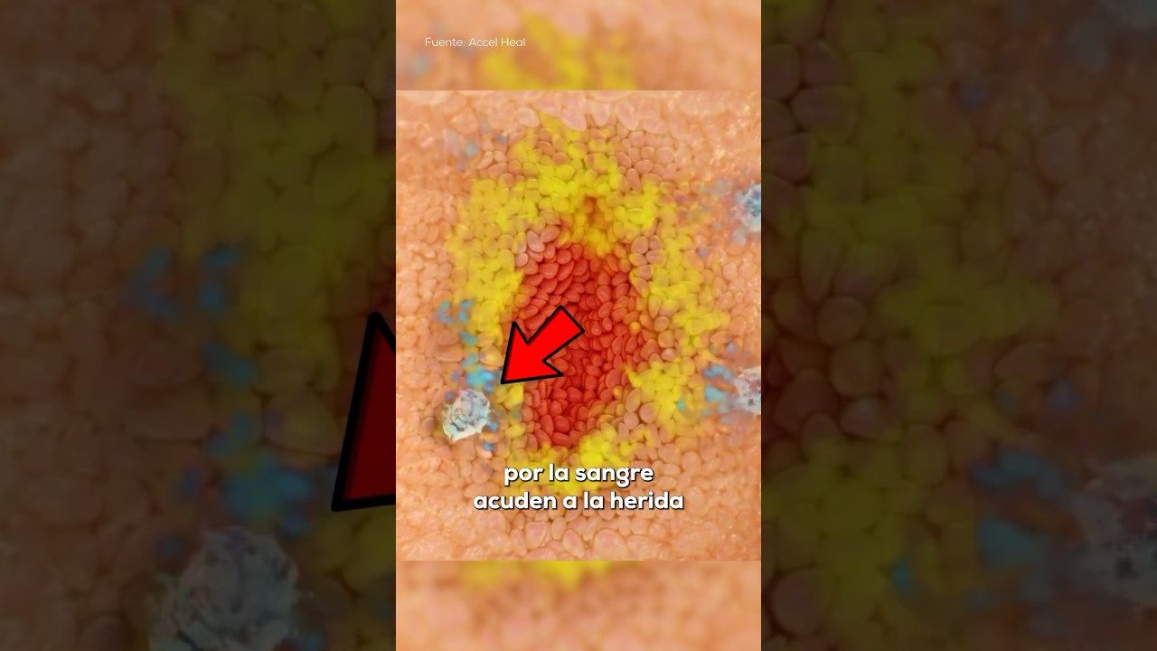 heridas en la piel que no se curan