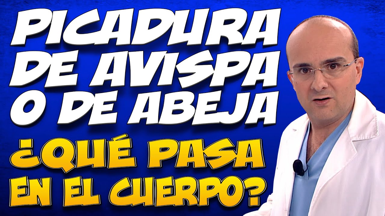 que poner en picadura de avispa