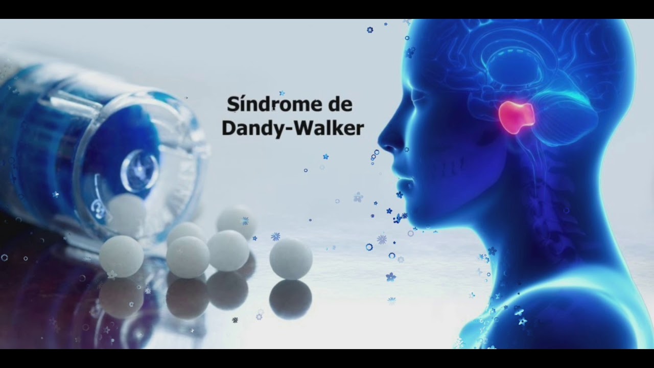 sindrome de dandy walker expectativa de vida