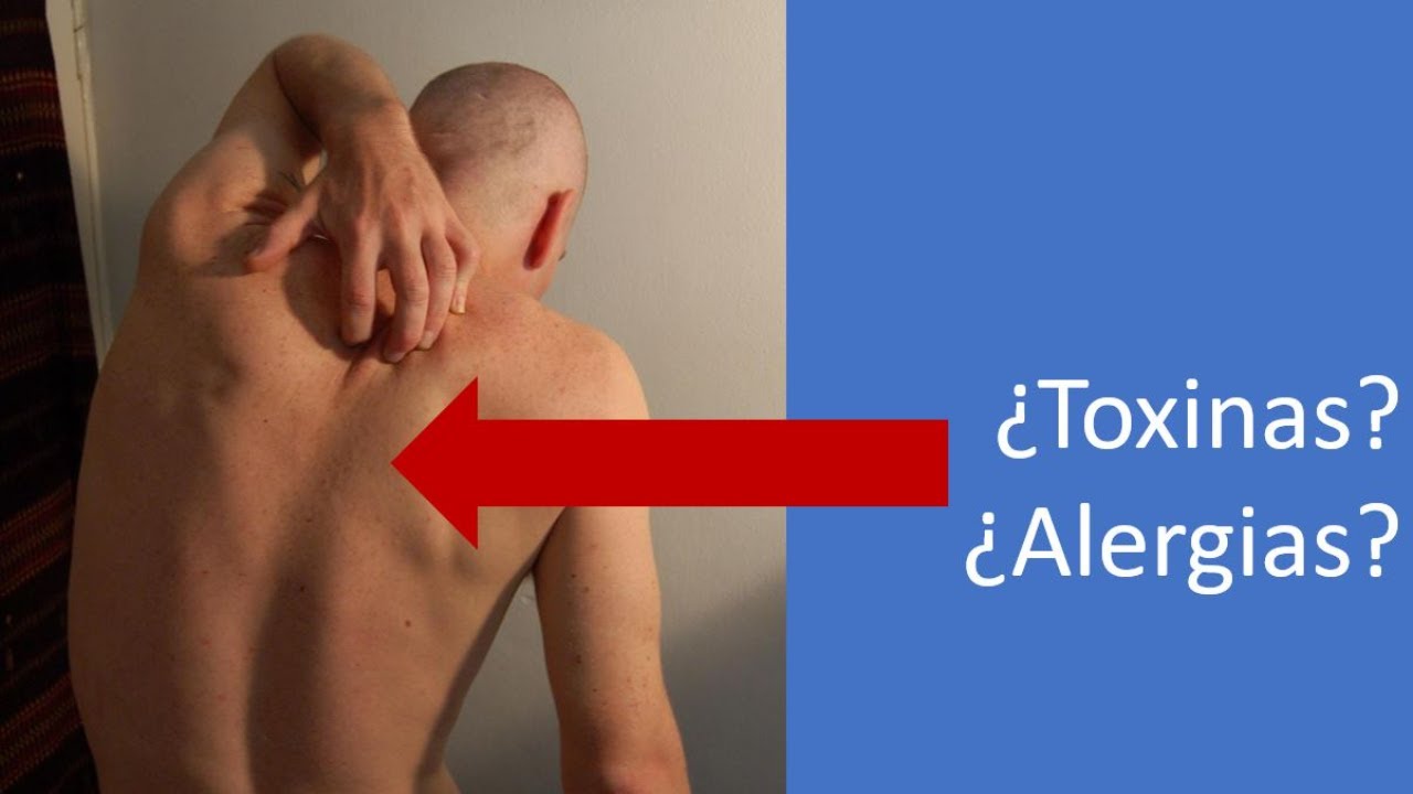 insomnio y picores en el cuerpo