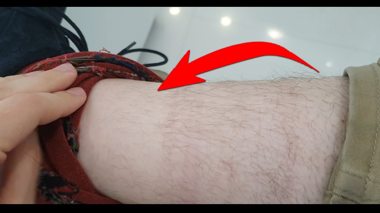 me ha dejado de salir pelo en las piernas